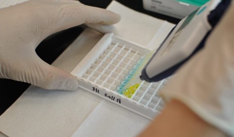 Choosing The Right Assay Kits For Your Research Needs